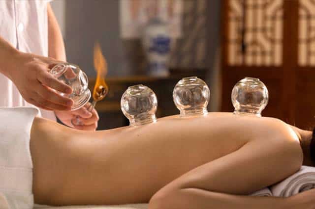 Traditional Cupping